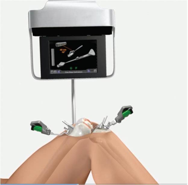 Knee Replacement Operation Knee Replacement Best Hospital Acl